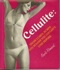 Cellulite: those lumps, bumps, and bulges you couldn't lose before
