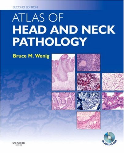 Atlas of Head and Neck Pathology with CD-ROM (Atlas of Surgical Pathology)